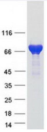 SDS-PAGE (SYN1-4848H).jpg